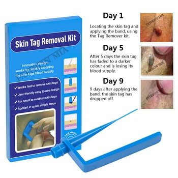 Medicale Piele Îndepărtarea Tag-ul Kit Micro Trupa Tag-uri Pielii Negi Remover Patch Cu Tampoane dezinfectante tratamentul negilor fata de îngrijire a Pielii Instrument