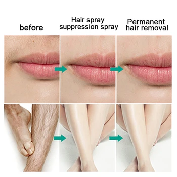 Permanent Opri Cresterea Parului Inhibitor Hair Repair Corp depilatoare Spray-Tratament Facial Hair Remover loțiune după ras pentru Femei
