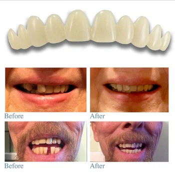 Noul Confortabil Fixați Pe Bărbați Femei Dinte Zambet Perfect Comfort Fit Flex Dinților Se Potriveste Zâmbet De Albire Dinti Falsi Acoperi