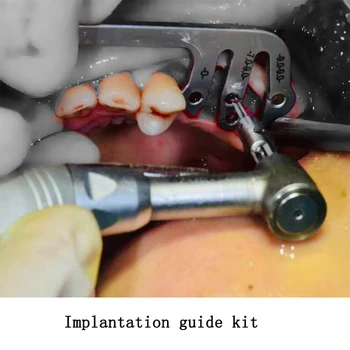 Implanturile dentare instrumente orală plantare ghid de poziționare implant dentar instrumente de plantare de poziționare unghi conducător instrumente stomatologice