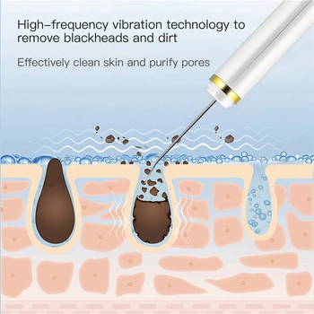 Ultrasunete Facial Skin Scrubber Ion Profundă Față de Epurare Porii Peeling Profund Curat USB Reîncărcabilă de Îngrijire a Pielii Dispozitiv Instrument de Frumusete
