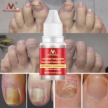 MeiYanQiong Lavanda Unghii Essence Repararea Anti-fungice Infecție Unghiilor de mâini și de Picioare de Îngrijire a Unghiilor Promovează Regenerarea Unghiilor 10ml